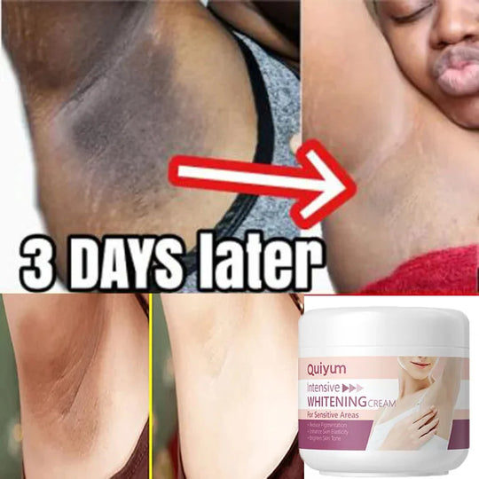 Whitening Cream Private Parts Underarm Bleaching Whiten Butt Knee Brighten Inner Thigh Intimate Parts Dark Remove Melanin Care