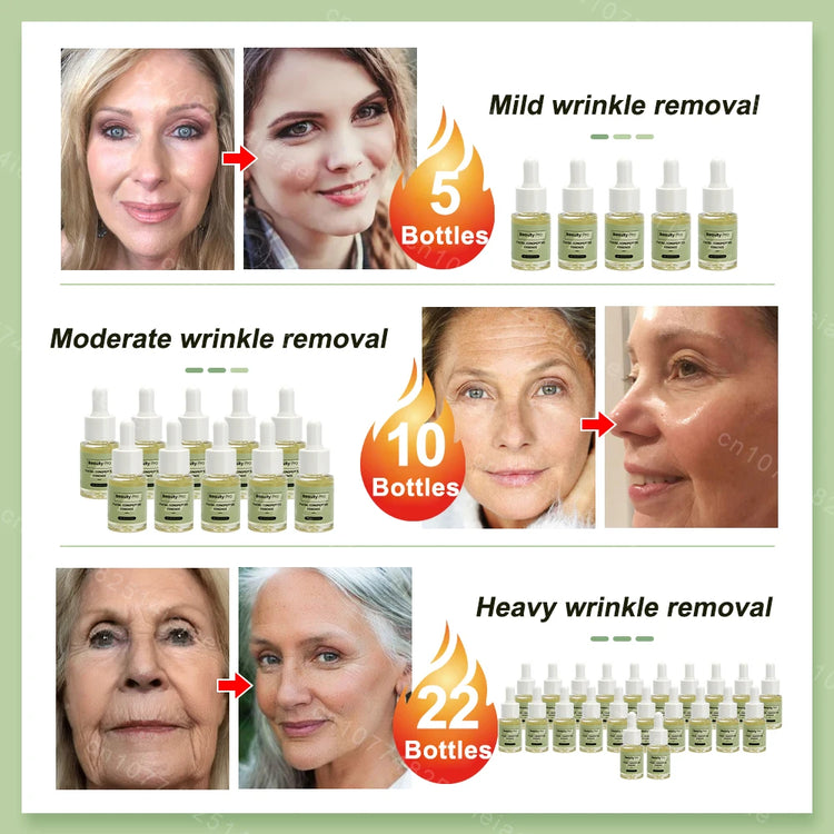 facial neck hand feet Anti-wrinkle  wrinkle removal essence anti aging serum skin care Lift tighten reduce fine lines moisturize